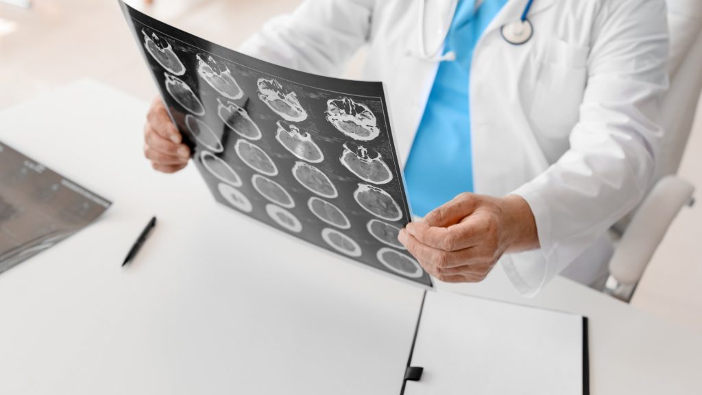 Mount Vernon Traumatic Brain Injury Lawyer
