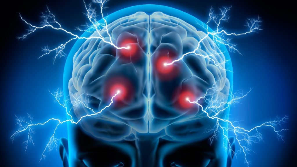 Mount Vernon Traumatic Brain Injury Lawyer