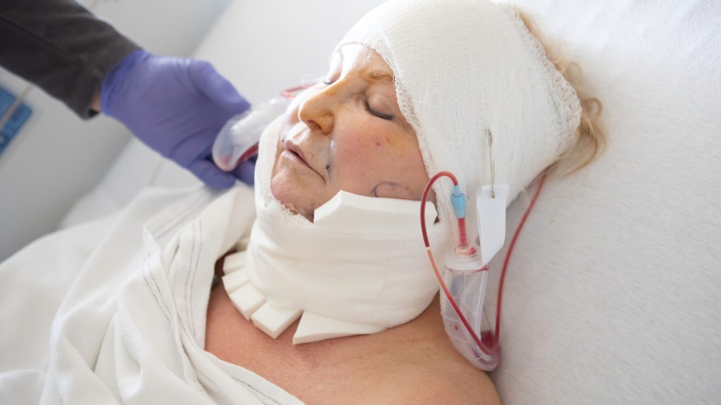 New Rochelle Traumatic Brain Injury Lawyer